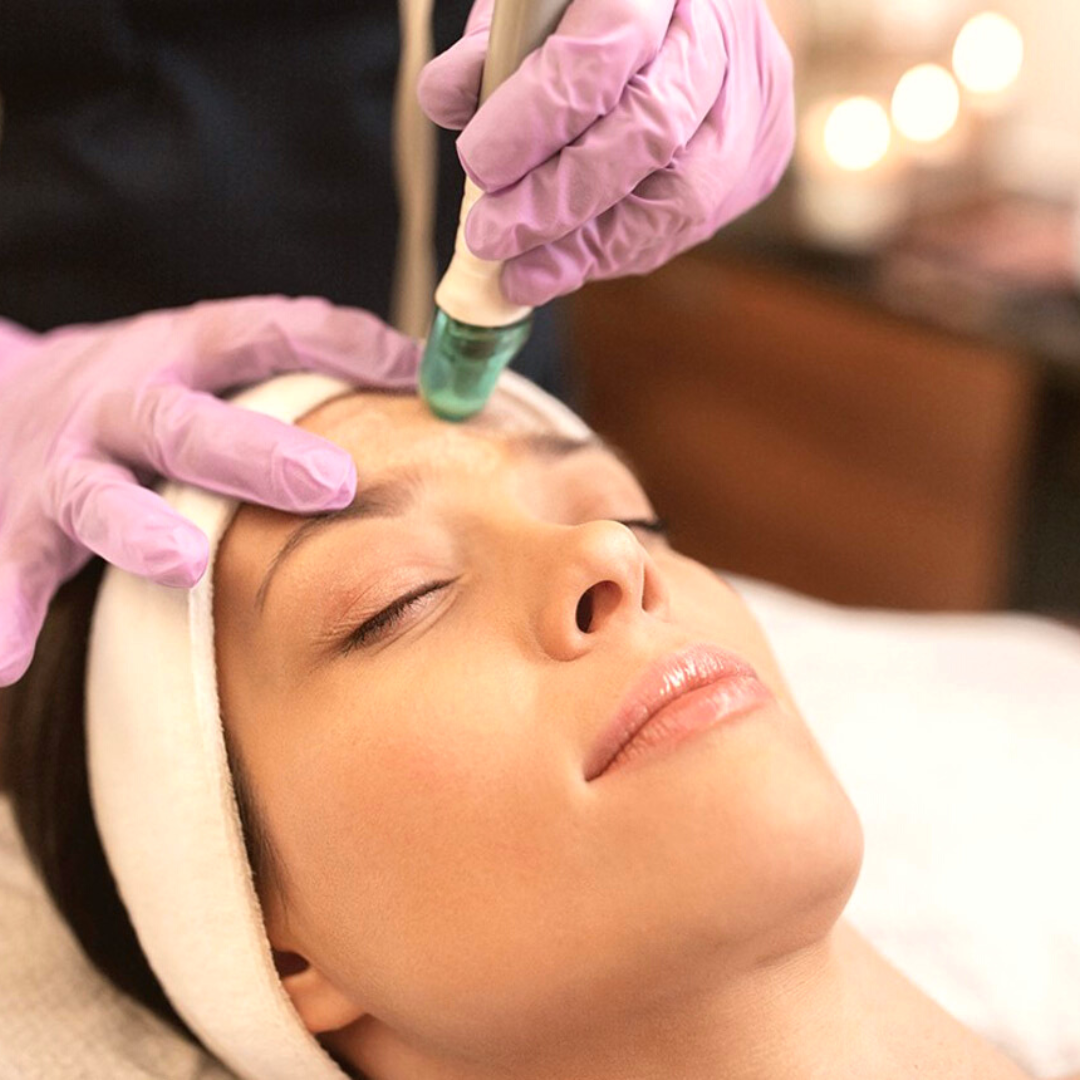 Hydro Dermabrasion Treatment